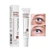 Eye Bag Removal RETINOL Eye Cream